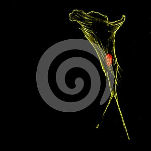 Immunofluorescence confocal imaging of a single cancer cell