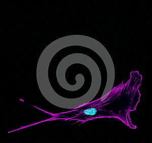 Immunofluorescence confocal imaging of a single invading metastatic prostate cancer cell sticking out protrusions with photo