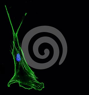 Immunofluorescence confocal imaging of a single invasive lung cancer cell