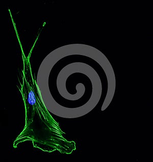 Immunofluorescence confocal imaging of a single invasive lung cancer cell photo