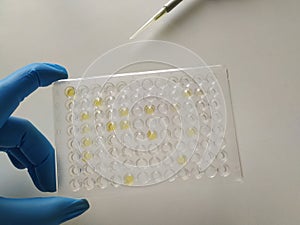 Immunology testing method in laboratory