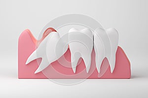 impacted wisdom tooth isolated background