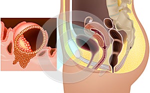 Implantation of fertilized ovum in uterus. Implanted human embryo in the womb. Prenatal development