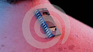 Implanted chip on the neck of a man