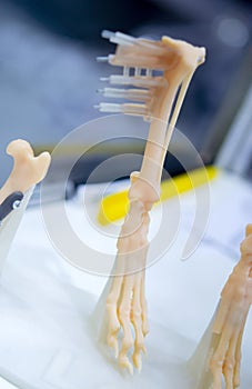 Implants and prostheses printed on 3D printer from biocompatible titanium powder