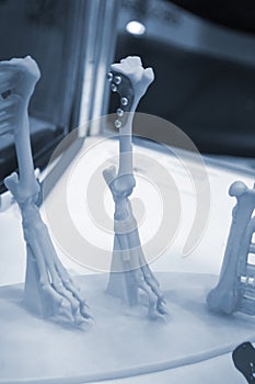 Implants and prostheses printed on 3D printer from biocompatible titanium powder