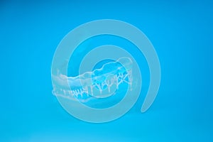 Impression of clear aligner to correct overbite