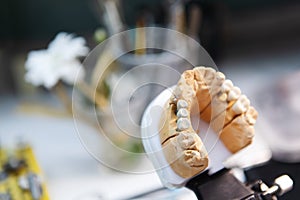 Impression of a human jaw with teeth. Modeling and shaping the dentition. Foreground photo