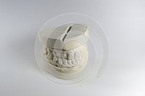 imprint dentition