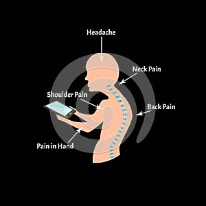 Improper posture symptoms. Text Neck Syndrome. Spinal curvature, kyphosis, lordosis, scoliosis, arthrosis. Improper