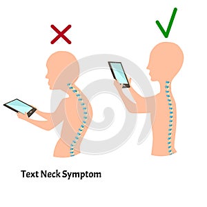 Improper posture symptoms. Text Neck Syndrome. Spinal curvature, kyphosis, lordosis, scoliosis, arthrosis. Improper photo