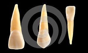 Incisor and canine teeth isolated on black