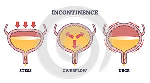 Incontinence problem with stress, owerflow and urge types outline diagram photo