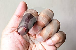 Index finger with indelible ink stain after voting in election photo