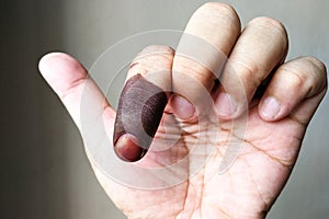 Index finger with indelible ink stain after voting in election photo