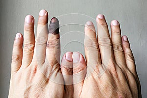 Index finger with indelible ink stain after voting in election photo