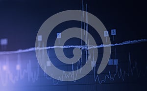 Index graph of stock market financial indicator analysis on LED.