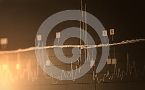 Index graph of stock market financial indicator analysis on LED.