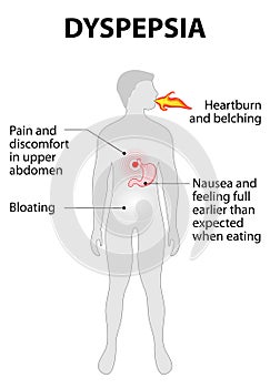 Indigestion or dyspepsia