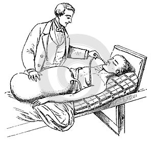 Induction of artificial respiration in the case of attacks of suffocation.