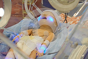 Infant dummy in neonatal intensive-care unit photo