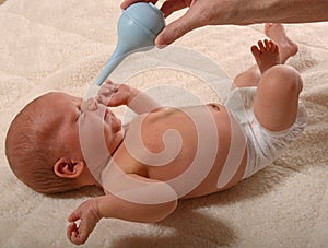 Infant and nasal aspirator