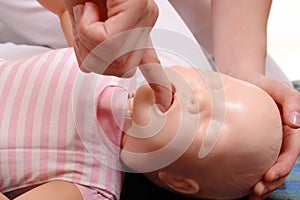 Infant suffocation rescue technique