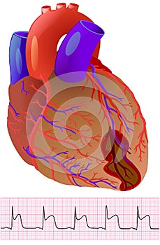 Infarct: colorful human heart and cardiogram on the white photo