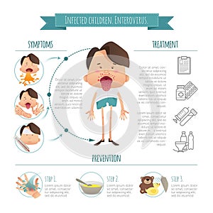 Infected children. Enterovirus. Hand-foot-mouth disease Infographics. Symptoms, prevention and treatment. Poster detail photo