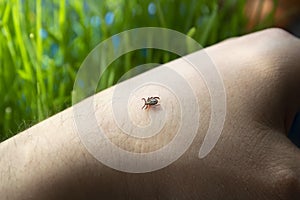 Infected dangerous tick on human skin - a carrier of infections and viruses
