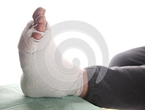 Infected foot of diabetic photo