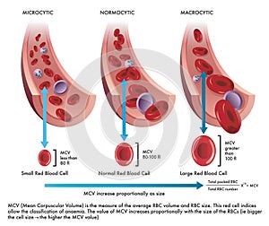 Infected red blood cells photo