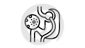 infection bariatric line icon animation