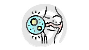 infectious arthritis color icon animation