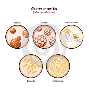 Infectious diarrhea. Close-up of pathogens of intestinal infections