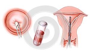 Infertility Tests