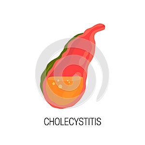 Inflamed gallbladder, vector concept of cholecystitis