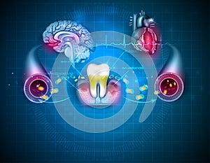 Inflamed gums