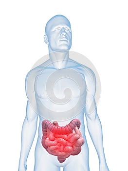 Inflamed intestines