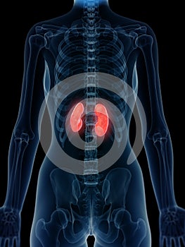An inflamed kidneys