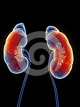 Inflamed kidneys