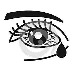 Inflammated eye Conjunctivitis or pink eye