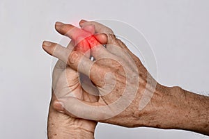 Inflammation of Asian man middle finger and hand. Concept of arthritis or cellulitis photo