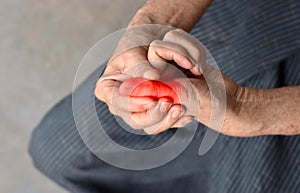 Inflammation of Asian man thumb and hand. Concept of cellulitis and finger problems photo