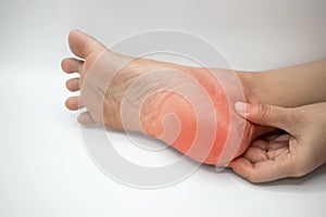 Inflammation at heel. Concept of foot pain photo