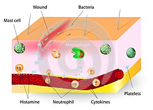 Inflammation. innate immune system photo