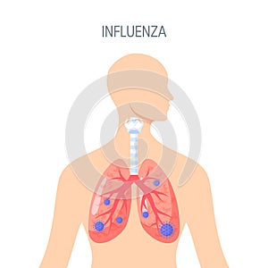 Influenza disease vector icon in flat style