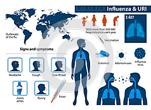 Influenza & Upper respiratory tract infections