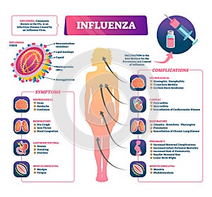 Influenza vector illustration. Labeled flu symptoms and complication scheme