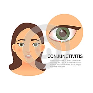 Infografic eyes disease